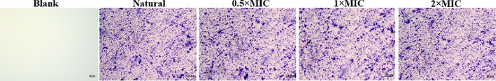 The biofilm inhibition micrographs of S.aureus processed by different MIC of NIE emulsion.