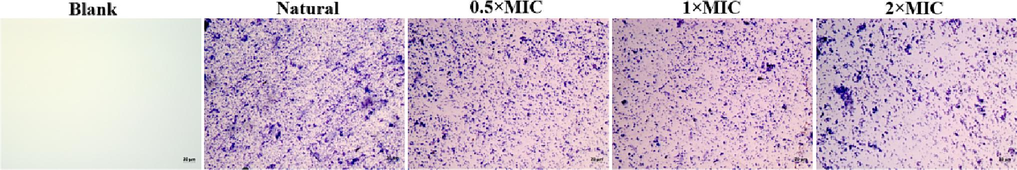 The biofilm disruption micrographs of S.aureus dealt with different MIC of NIE emulsion.