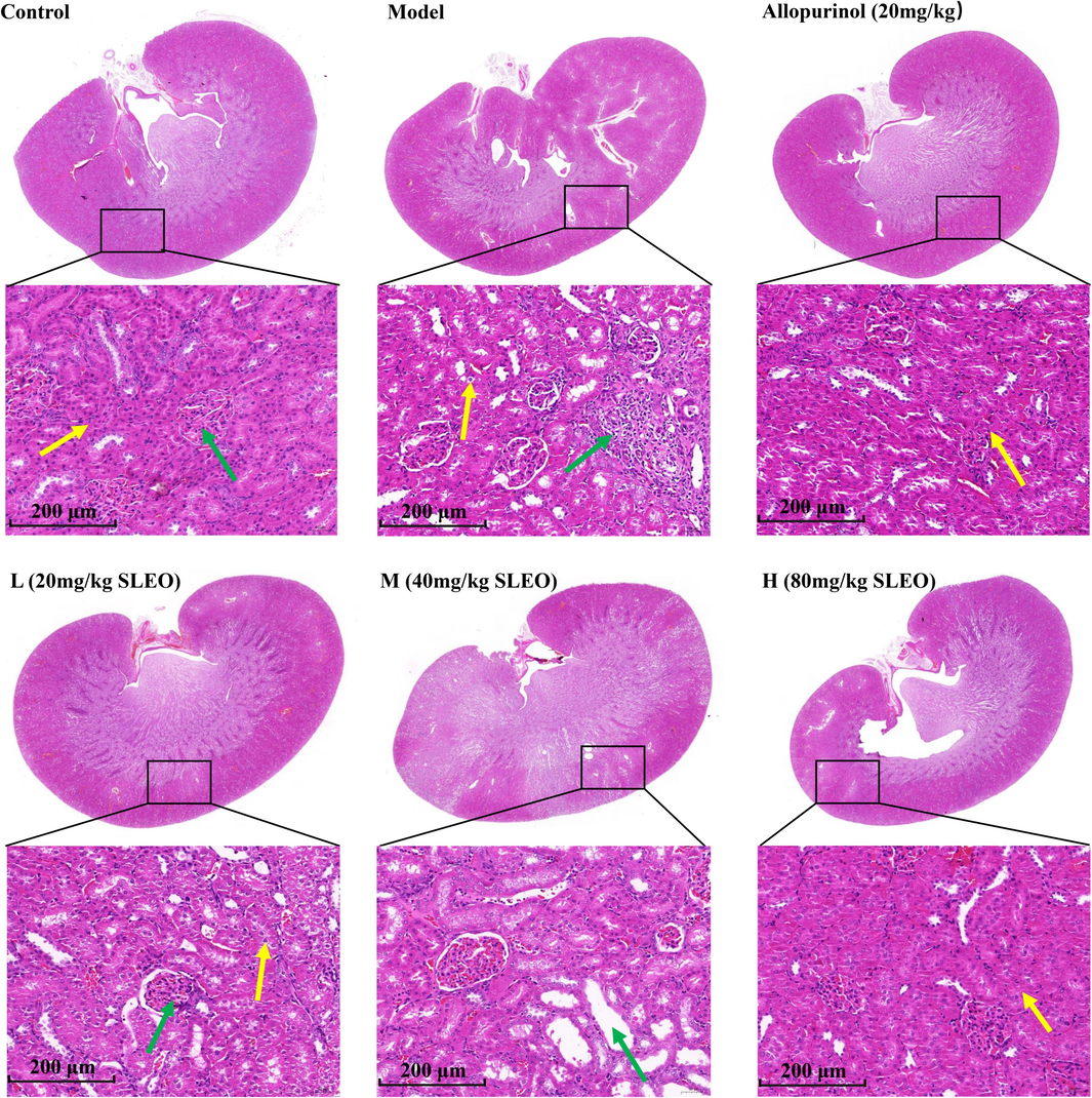 HE staining of rat kidney tissues after treatment of hyperuricemia with SLEO. Renal tissues in the model group had more severe infiltration of inflammatory factors compared with those in the control group, while the renal histopathology of rats in the high-dose group was significantly improved by SLEO treatment.