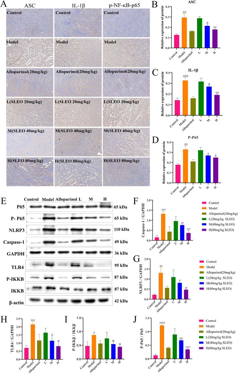 A-D The immunohistochemical detection of protein expression in the renal tissues of rats in various group. E-J The detection of protein expression in the kidney tissues of rats in each group by Western blotting. (Standard deviation ± mean (n = 3), *P<0.05, **P<0.01, ***P<0.001, ****P<0.0001 vs. Model group., #P<0.05, ##P<0.01, ###P<0.001, ####P<0.0001 vs. Control group.).