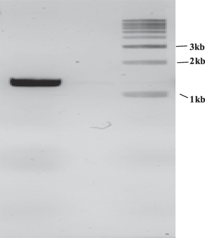 Amplification of collagenase gene by PCR from Bacillus siamensis strain Z1.