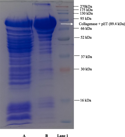 SDS-PAGE analysis of recombinant collagenase. (A) Z1 pET crude collagenase (B) Z1 pET MBP tagged Affinity purified collagenase (Lane 1) protein molecular weight marker.