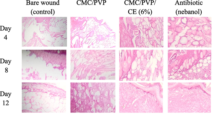 H & E staining of the wound sections collected on days 4, 8 and 12 in albino mice model. Control group is untreated bare wound, and experimental group is treated with two different films (CMC/PVP, CMC/PVP/CE (6%), and antibiotic.