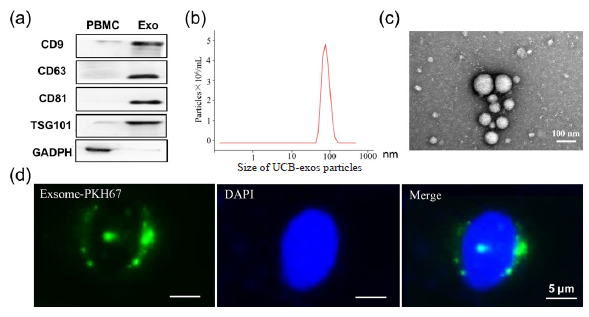 UCB exosome identification. (a) Exosome-specific markers such as Tetraspanin 9 (CD9), Lysosomal membrane-associated glycoprotein 3 (CD63), CD81, and Tumor susceptibility antigen 101 (TSG101) were detected by Western blot; (b) Nanoparticle tracking analysis (NTA) for determining the size of exosome particles (30 to 150 nm); (c) Morphological observation of exosomes under transmission electron microscopy; and (d) Internalization of PKH67-labelled exosomes by cells was observed using laser confocal microscopy. PBMCs: peripheral blood mononuclear, GAPDH: Glyceraldehyde-3-phosphate dehydrogenase, Exo: exosomes, DAPI: 4’,6’-Diamidino-2-phenylindole, Blue is the nucleus, Green is the exosomes.