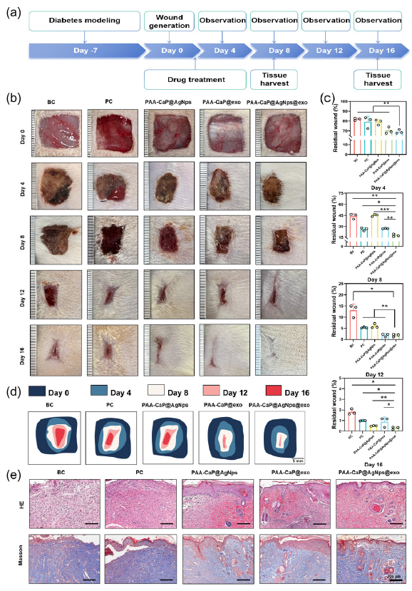 The antimicrobial properties of hydrogels in vitro. (a) Detection of the antimicrobial activities of AgNps, PAA-CaPs@AgNps, and PAA-CaPs@AgNps@exo hydrogels on S. aureus and E. coli by the ring-of-inhibition assay; (b) Statistical results of the inhibitory rings of the AgNps, PAA-CaPs@AgNps, and PAA-CaPs@AgNps@exo hydrogels on S. Aureus and E. coli; (c) The antimicrobial effect of PAA-CaPs@AgNps@exo hydrogel evaluated by plate counting method; (d) Quantitative results of the inhibitory effect of PAA-CaPs@AgNps@exo hydrogel on E. coli and S. Aureus. (n=3, mean±SD, *p < 0.05, **p < 0.01, ***p < 0.001). (e) Histological examination the skin tissue of different groups by Hematoxylin and eosin (HE) staining and Masson’s trichrome (Masson) staining (50x). BC: Blank control, PC: Positive control.