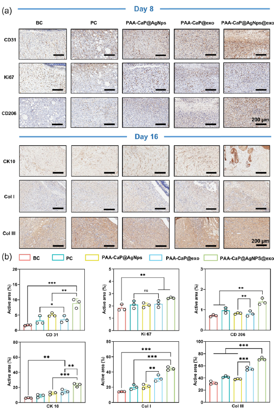 PAA-CaP@AgNps@exo hydrogel promotes angiogenesis, cell proliferation, anti-inflammation, re-epithelialization, and collagen deposition. (a) Immunohistochemical staining images of CD31, Ki67, CD206 expression on day 8, and CK10, COLI, COLIII expression on day 16 in the skin wounds of diabetes rats with different treatments; (b) The quantitative results of the CD31, Ki67, CD206, CK10, COLI, and COLIII expression detected by immuno- histochemical staining (n = 3, mean ± SD, *p < 0.05, **p < 0.01, ***p < 0.001). BC: Blank control, PC: Positive control, CD31: Platelet endothelial cell adhesion molecule-1, KI67: Marker of Proliferation Ki-67, CD206: Mannose Receptor C-Type 1, CK10: Cytokeratin 10, Col I: Collagen Type I, Col III: Collagen Type III. The black circles represent the experimental results from independent repetitions of the experiment.