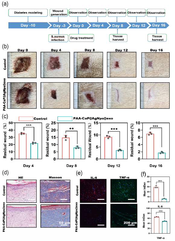 PAA-CaP@AgNps@exo hydrogel accelerates bacteria-infected diabetic wound healing. (a) Schematic diagram of the experimental procedure; (b) Images of wound healing of diabetic rats treated by PAA-CaP@AgNps@exo hydrogel at different time points; (c) Graph of statistical calculations of the residual wound area at different time points (n=3, mean±SD, *p < 0.05, **p < 0.01, ***p < 0.001); The black circles represent the experimental results from independent repetitions of the experiment. (d) Hematoxylin and eosin (HE) and Masson staining images of the skin wounds tissue on day 16; (e) Immunofluorescence staining images of Interleukin-6 (IL-6), and Tumor Necrosis Factor alpha (TNF-alpha), expression at the wound site on day 8; (f) Quantitative results of IL-1, and TNF-, expression in the regenerated skin tissue at day 8 (n = 3, mean ± SD, **p < 0.01, ***p < 0.001). (Hematoxylin and Eosin staining (HE) magnification 50x)