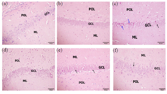 Photomicrograph of hippocampus morphology; (a) Control hippocampus showing a normal view of compact aggregations of granule neurons called granule cell layer (GCL) in between polymorphic layer (POL) and molecular layer (ML). (b) Control hippocampus treated with Ruta oil (RO) revealing normal view of compact aggregations of granule neurons in GCL. (c) The hippocampus of the socially isolated group exhibits shrunken and dead pyramidal neurons (blue arrows) and degenerated and faded granular neurons (black arrow) in the GCL. (d) Hippocampus of socially isolated rats treated with fluoxetine displaying marked improvement represented by aggregations of abundant good-looking granular neurons in GCL. (e) The hippocampus of socially isolated rats treated with RO (200 mg/kg) showed some improvement except for some shrunken and degenerated granular neurons in the GCL. (f) The hippocampus of socially isolated rats treated with RO (400 mg/kg) posting obvious improvement represented by healthy granular neurons in GCL. (Hematoxylin and eosin, 200x).