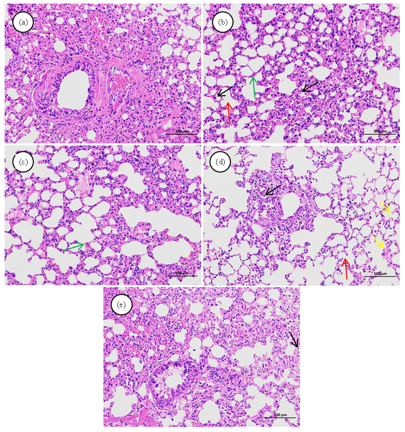 Hematoxylin and eosin (HE) stained histopathological sections of lung tissue from the (a) control, (b) model, (c) positive, (d) ZSD-L, and (e) ZSD-H groups. The colored arrows illustrate various histopathological alterations in the lungs under different experimental conditions. (magnification, 200×). (The red arrows denote the partial loss of alveolar septa and the coalescence of alveoli into alveolar sacs. Black arrows indicate widespread infiltration of inflammatory cells within the tissue. Green arrows signify hyperplasia of alveolar epithelial cells and thickening of the alveolar septa. Yellow arrows highlight pronounced capillary dilation in the alveolar wall sections.)