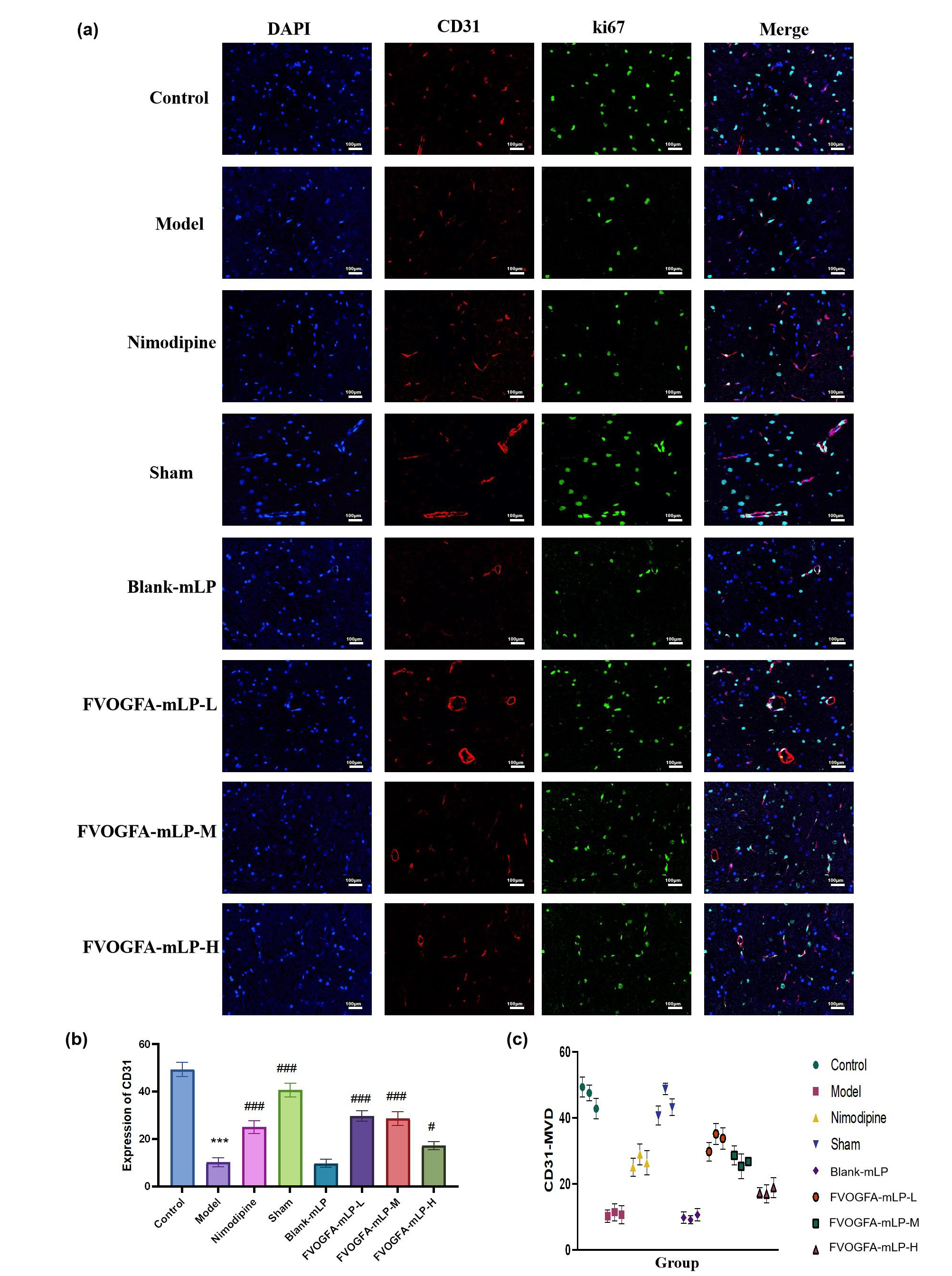 (a) The immunofluorescence staining of CD31+/Ki67+ in the ischemic cerebral cortex (scale bar = 100 µm). The red dye is CD31+, the green dye is Ki67+, and the blue is DAPI. (b) The expression of CD31+ in the ischemic cerebral cortex, and (c) the expression of Ki67+ in the ischemic cerebral cortex. Compared with the control group: *p < 0.05, **p < 0.01, ***p < 0.001. Compared with the model group: #p < 0.05, ##p < 0.01, ###p < 0.001.