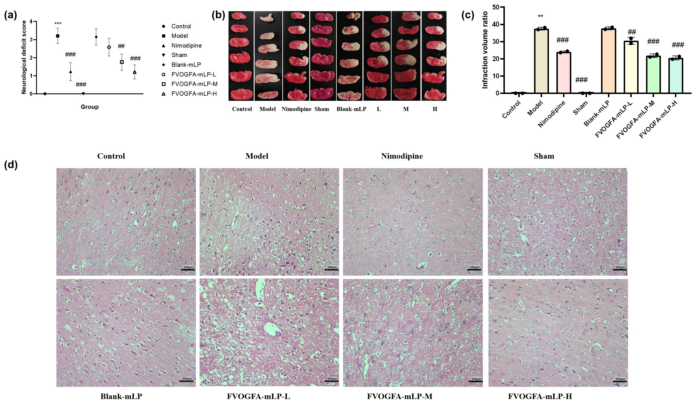 (a) Neurological deficit score of different groups. Effect of FVOGFA-mLP on cerebral infarct area and cerebral ischemia volume ration of MCAO rats, (b) the results of the TTC staining, (c) the infarction rate in different groups. (d) The results of histopathological studies (H&E staining, 200×) on MCAO rats in each group (scale bar = 200 µm). Compared with control group: *p < 0.05, **p < 0.01, ***p < 0.001. Compared with the model group: #p < 0.05, ##p< 0.01, ###p< 0.001.