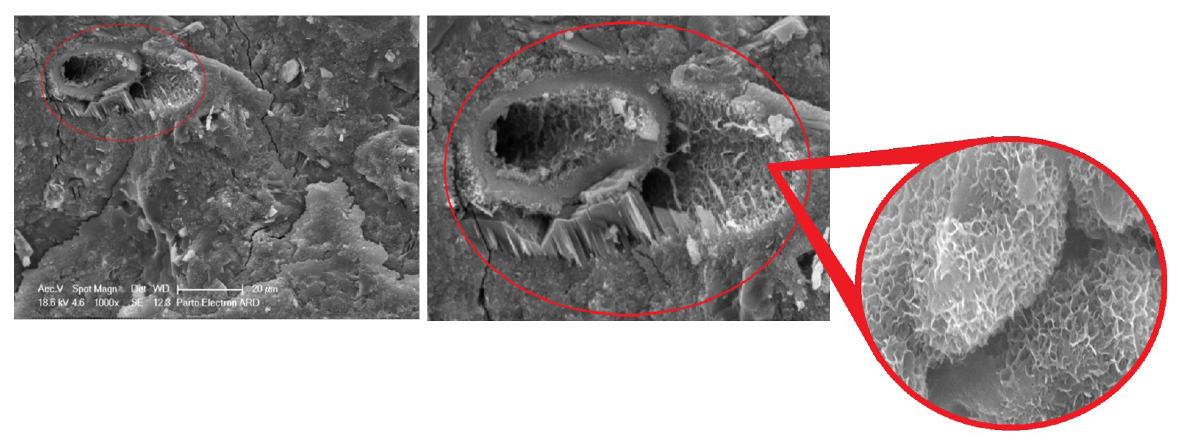 The hydroxyapatite structure in previous electron microscopy studies.